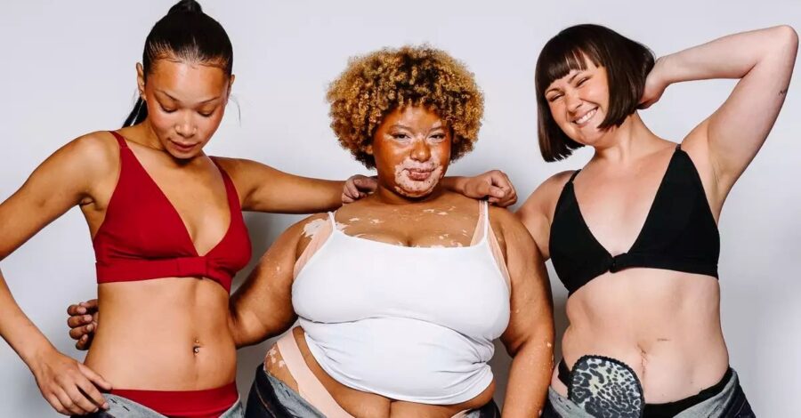 Three young models with visual differences pose proudly.